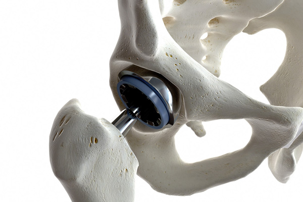 dott michele saporito ortopedico