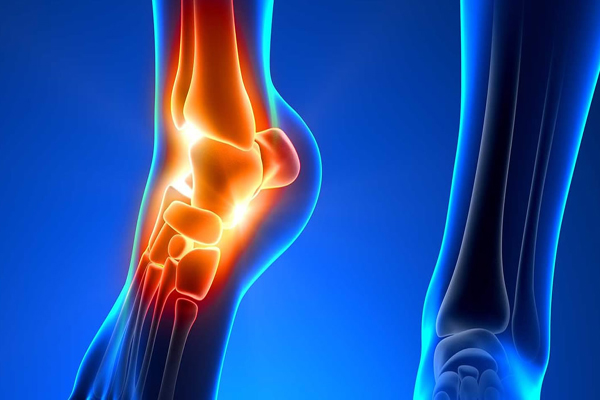 dott michele saporito ortopedico